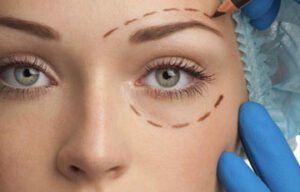 What are the main goals of modern Eyelid Surgery
