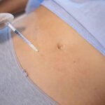 What makes Body Fillers different from other body treatments