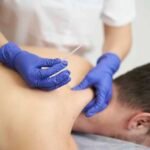 Professional dry needling services