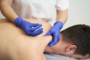 Professional dry needling services